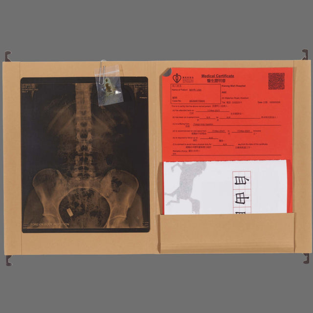 FOREIGN BODY INGESTION